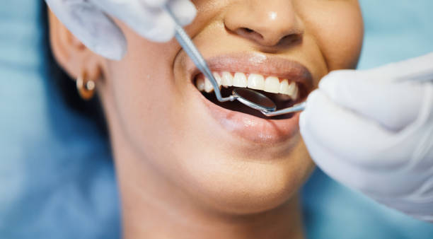 Best Teeth Whitening  in Utica, MI