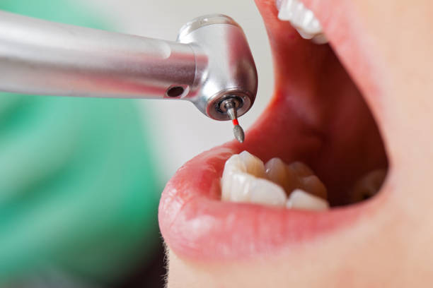 Best Urgent Tooth Repair  in Utica, MI